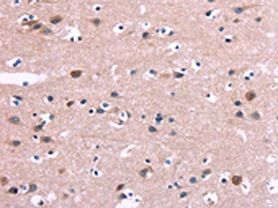 DUSP13 Antibody