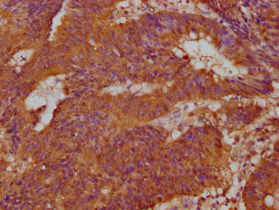 DUSP13 Antibody
