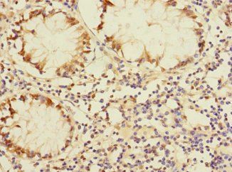 DUSP16 Antibody