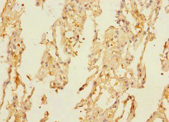 DUSP16 Antibody