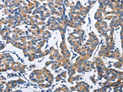 DUSP19 Antibody