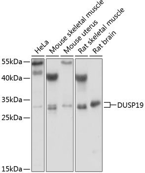 DUSP19 antibody