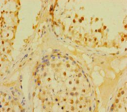 DUSP21 Antibody