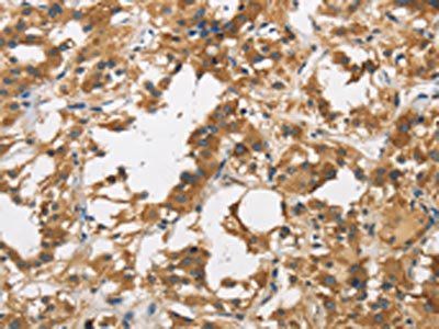 DUSP23 Antibody