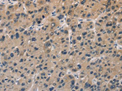 DUSP26 Antibody