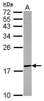 DUSP26 Rabbit Polyclonal Antibody