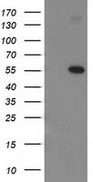 DUSP27 (DUPD1) antibody