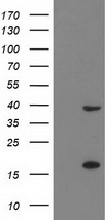 DUSP27 (DUPD1) antibody