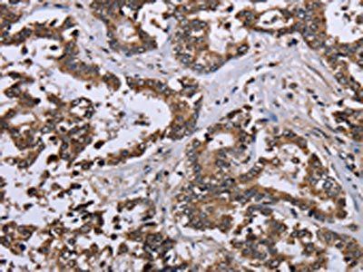 DUSP4 Antibody