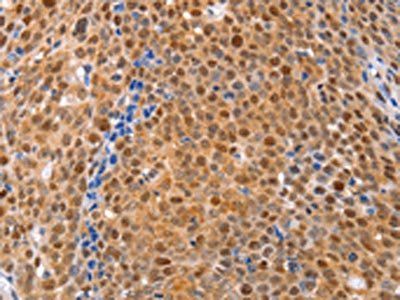 DUSP4 Antibody