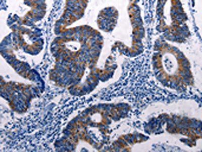 DUSP6 Antibody