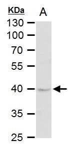 DUSP6 Rabbit Polyclonal Antibody