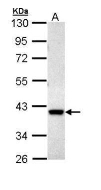 DUSP6 Rabbit Polyclonal Antibody