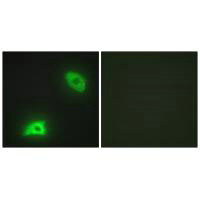 DUSP6 Antibody