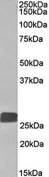 Goat anti-DUSP6 / MKP3 Antibody
