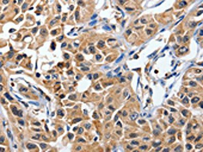 DUSP8 Antibody