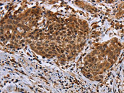 DUSP8 Antibody