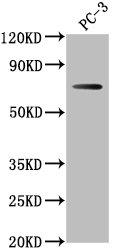 DVL1P1 Antibody