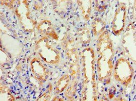 DVL2 Antibody
