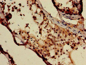 DXO Antibody