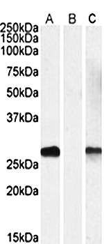 DYDC1 antibody