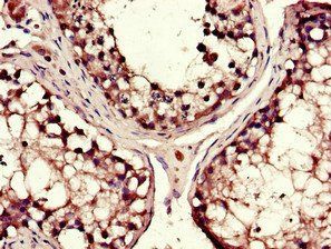 DYNC1H1 Antibody