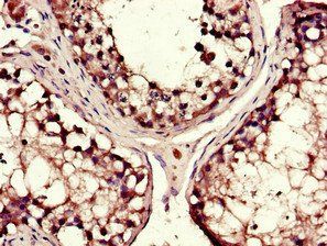 DYNC1H1 antibody