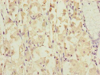 DYNC1I1 Antibody