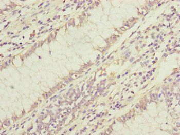 DYNC1I1 Antibody
