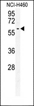 DYNC1LI2 antibody