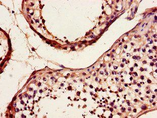DYNC2H1 Antibody