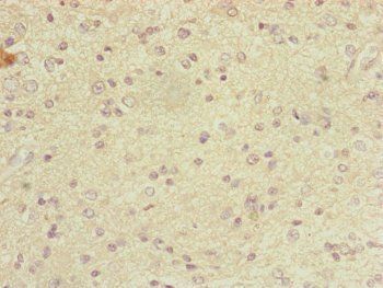DYNC2LI1 Antibody