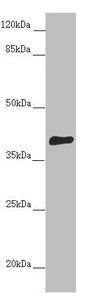 DYNC2LI1 antibody