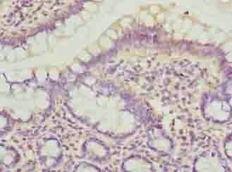 DYNLRB1 antibody