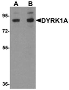 DYRK1A Antibody