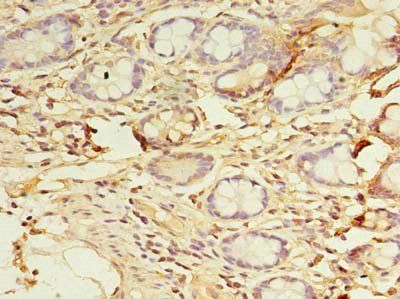 DYRK4 Antibody