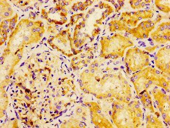 DYSF Antibody