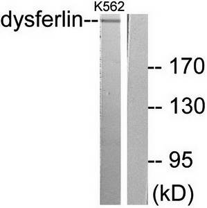 Dysferlin antibody