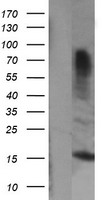 Dystrobrevin beta (DTNB) antibody