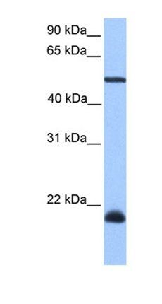 DYX1C1 antibody