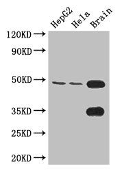 DYX1C1 antibody