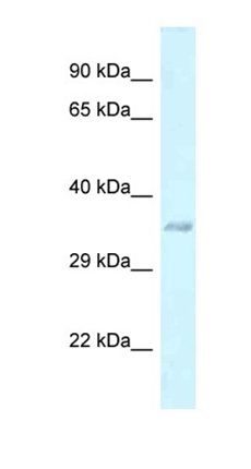 E130311K13Rik antibody