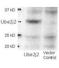 E2 J2 antibody