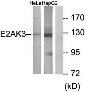 E2AK3 antibody
