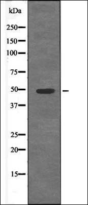 E2F1 (Phospho-Ser364) antibody