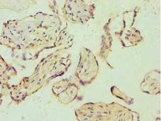 E2F6 antibody