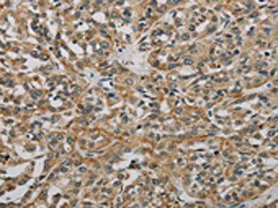 E2F6 Antibody