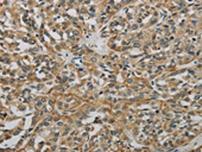 E2F6 antibody