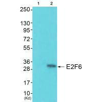 E2F6 antibody