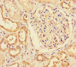 E3 ubiquitin-protein ligase MIB1 antibody